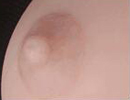 Skin Areola