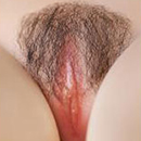 Pubic Hair:#1