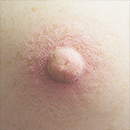 Areola Color Natural