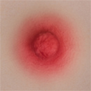 #2 Areola
