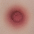 #4 Areola