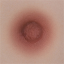 #5 Areola