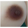 Brown Areola