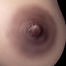 Black Areola