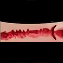 #1 13 cm (5.1 in) Vaginal Type