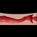 #2 14 cm (5.5 in) Vaginal Type