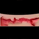 #3 15 cm (5.9 in) Vaginal Type