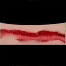 #5 17 cm (6.7 in) Vaginal Type