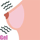 Gel-Filled Breast