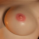 Gel-filled Breast Optionss