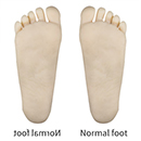 None Standing Feet