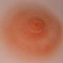 #2 Areola Colors