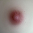 #2 Areola