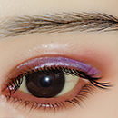 Yes Eyebrow and Eyelash Transplantation