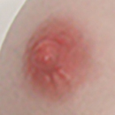 #1 Areola