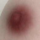 #2 Areola