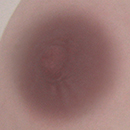 #3 Areola