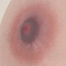 #4 Areola