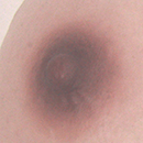 #5 Areola