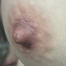 #7 Areola