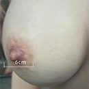 6 cm Areola