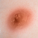 #2 Areola Color