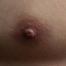 #1 Areola Color