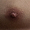 #2 Areola Color