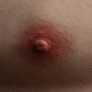 #3 Areola Color