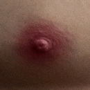 #4 Areola Color
