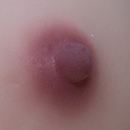 #3 Areola