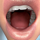 Yes Artificial Mouths