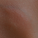 Yes Realistic Skin Texture