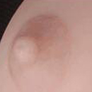 Skin Areola