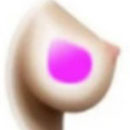Yes Gel-Filled Breasts