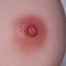 Natural Areola