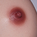 Red Brown Areola