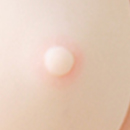 Skin Areola Color