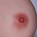 Areola Color Natural