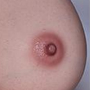 Areola Color Flesh