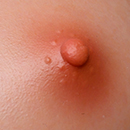 Light Brown Areola