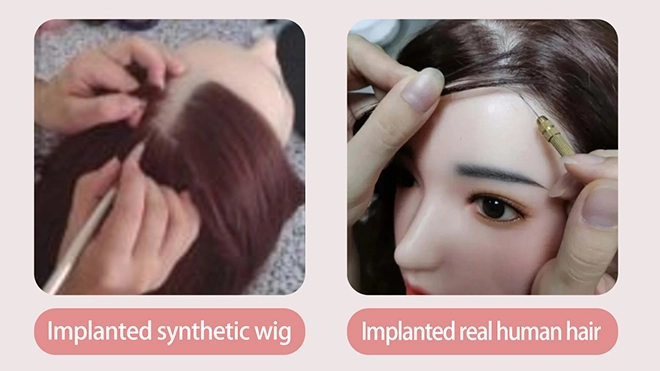 Implanted Hair