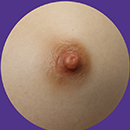 #1 Areola