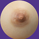 #3 Areola