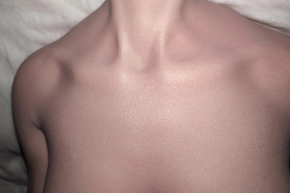 Actual Photos of Phoenix