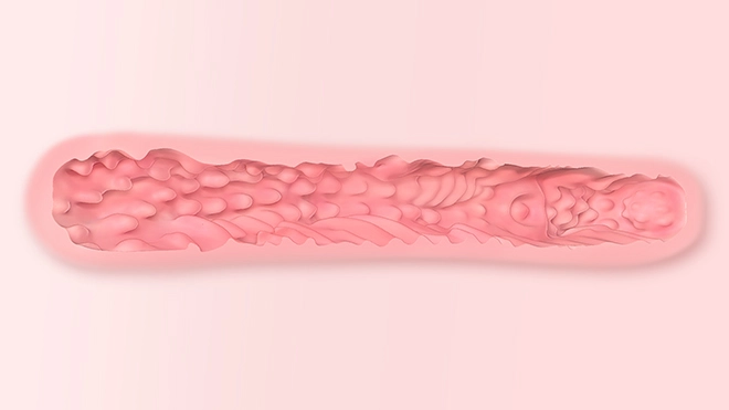 Spiral texture passage