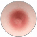 Red Brown Areola