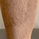 Yes Leg Hair