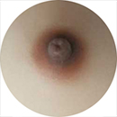 #6 Areola