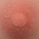 #4 Areola Color